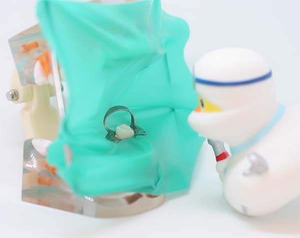 Коффердам при лечении зубов: почему он важен